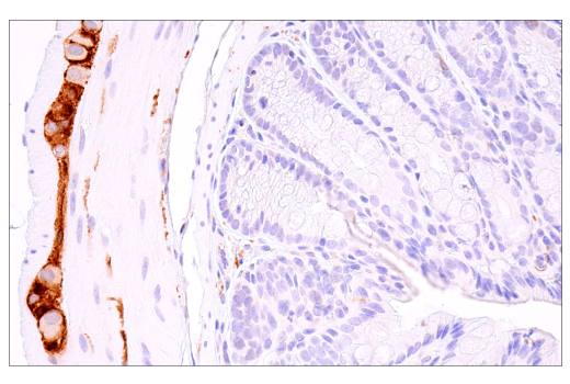 Immunohistochemistry Image 2: S100B (E9F2I) Rabbit Monoclonal Antibody (BSA and Azide Free)