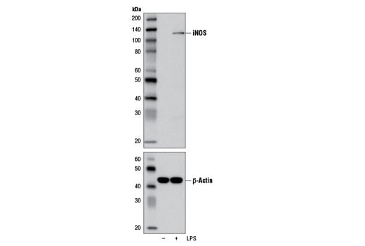 Western Blotting Image 1: iNOS (D6B6S) Rabbit mAb