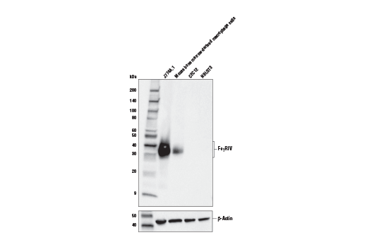 Western Blotting Image 2: Fc-gammaRIV (E8I7C) Rabbit Monoclonal Antibody