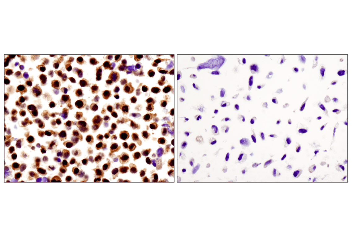 Immunohistochemistry Image 1: Stat3 alpha (D1A5) Rabbit Monoclonal Antibody (BSA and Azide Free)