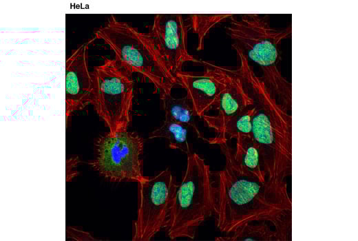Immunofluorescence Image 1: DDX5 (D15E10) Rabbit Monoclonal Antibody