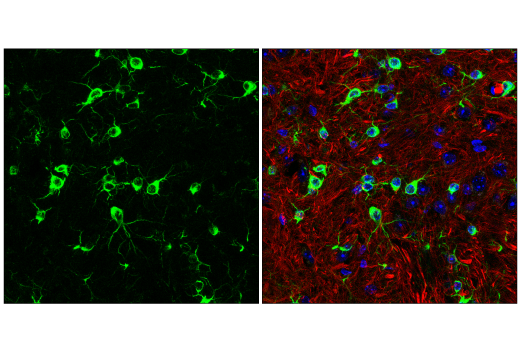 Immunofluorescence Image 3: MAP7 (E8K7O) Rabbit Monoclonal Antibody