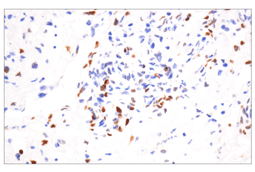 Immunohistochemistry Image 1: Phospho-Histone H2A.X (Ser139) (20E3) Rabbit Monoclonal Antibody (BSA and Azide Free)