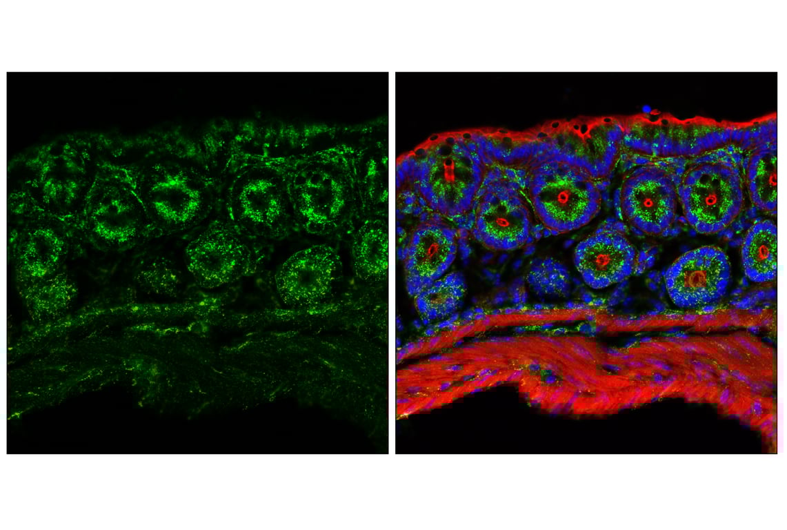 Immunofluorescence Image 1: LAMP2 (E6A6S) Rabbit Monoclonal Antibody