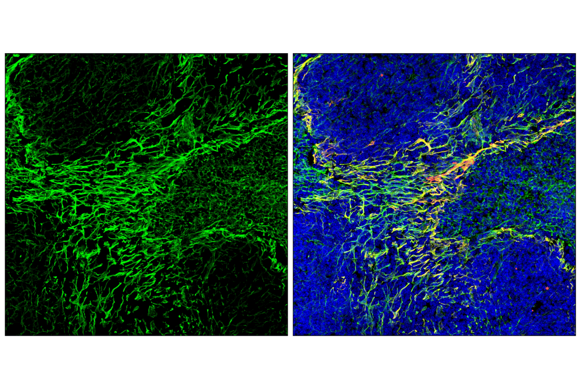Immunofluorescence Image 3: Caldesmon-1 (D5C8D) Rabbit Monoclonal Antibody