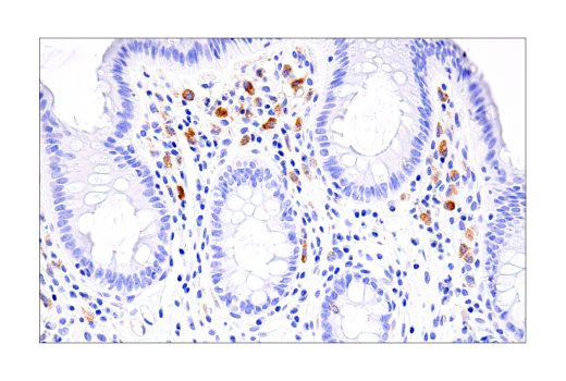 Immunohistochemistry Image 8: Cleaved Gasdermin D (Asp275) (E7H9G) Rabbit Monoclonal Antibody