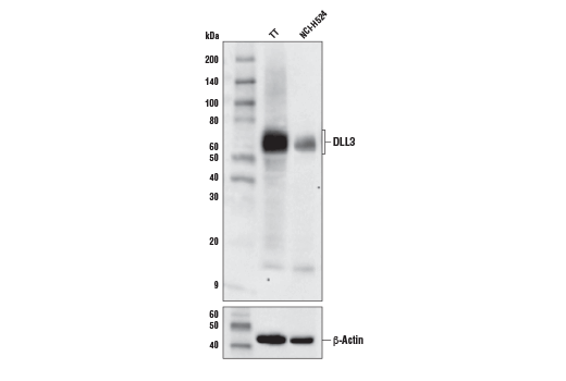 Western Blotting Image 1: DLL3 (E3J5R) Rabbit mAb