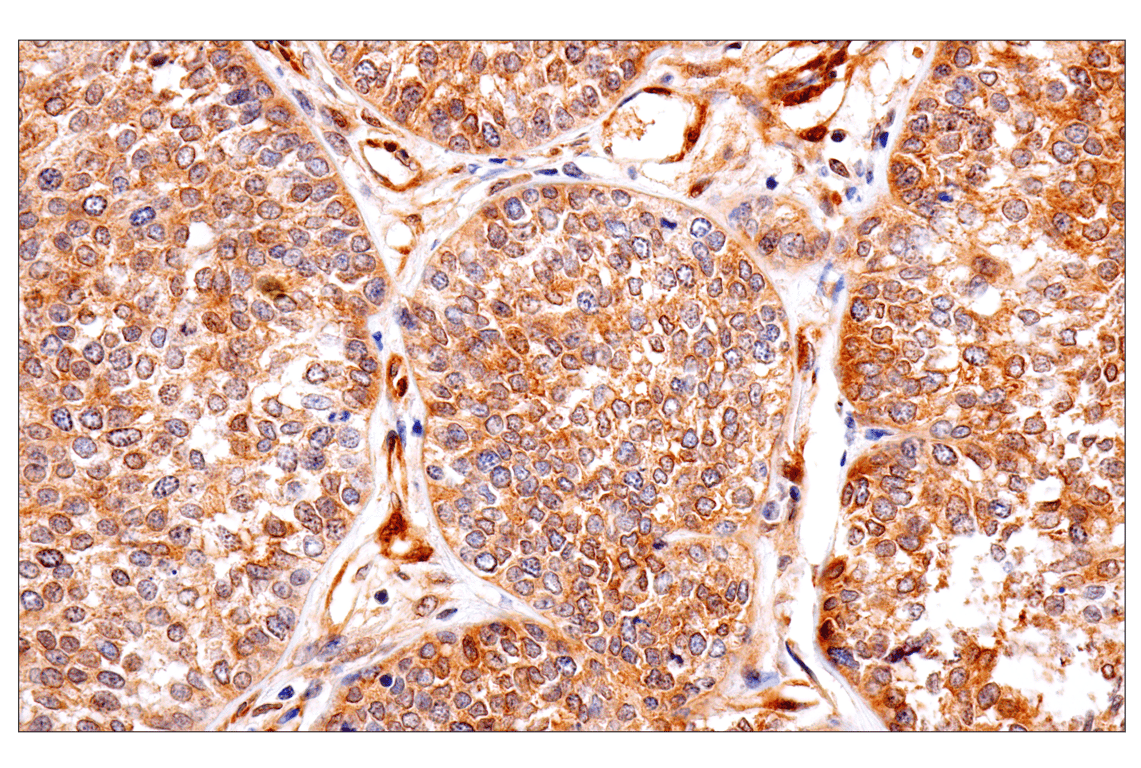 Immunohistochemistry Image 1: PTEN (138G6) Rabbit Monoclonal Antibody (BSA and Azide Free)