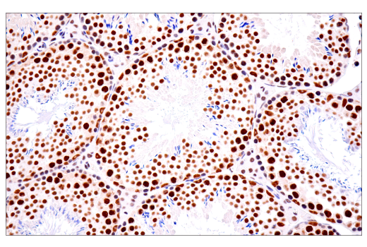 Immunohistochemistry Image 6: TDP43 (E2G6G) Rabbit Monoclonal Antibody