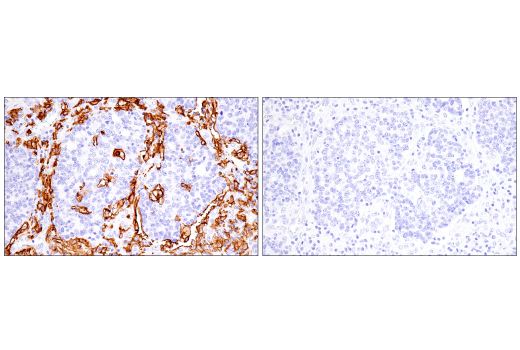 Immunohistochemistry Image 16: FcR gamma (E6Y1A) Rabbit Monoclonal Antibody (BSA and Azide Free)