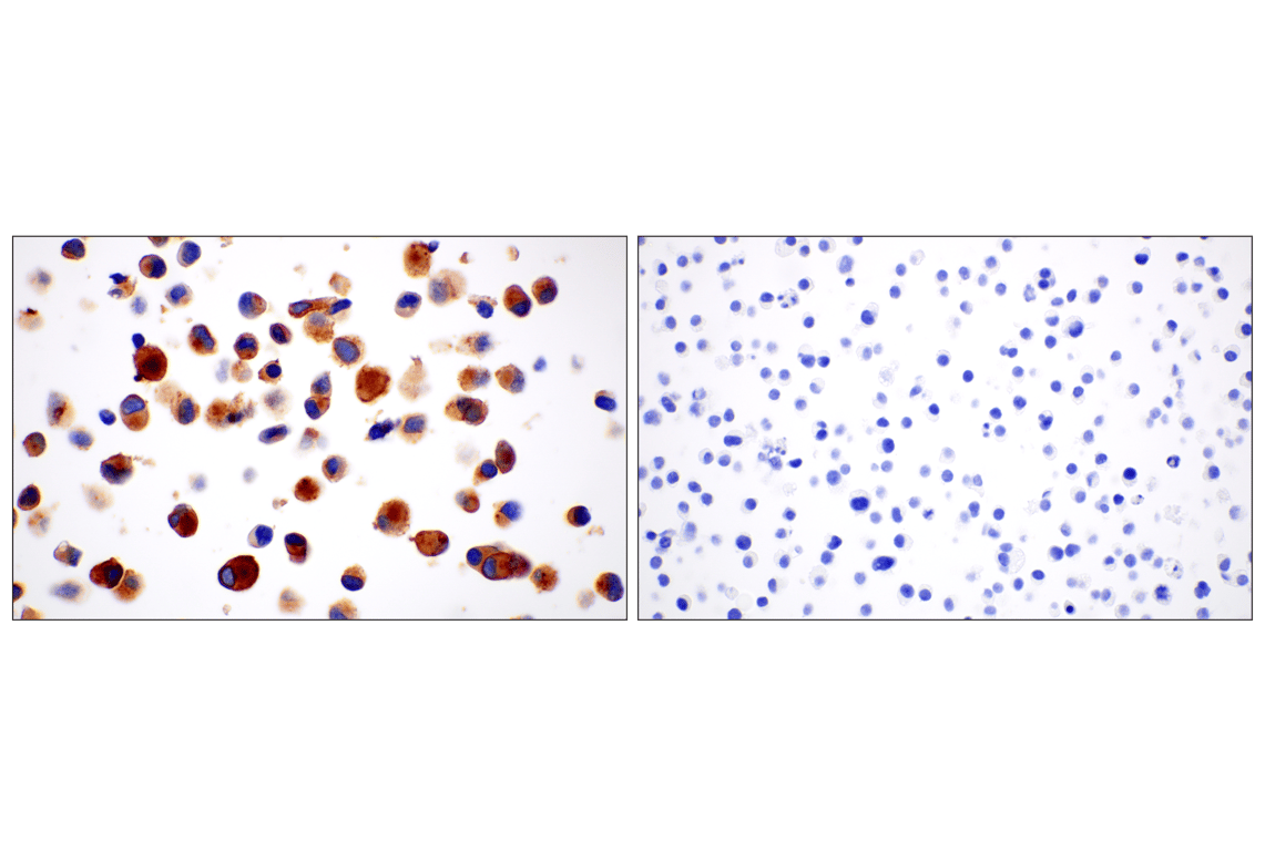 Immunohistochemistry Image 11: SCARB1 (E9H4F) Rabbit Monoclonal Antibody