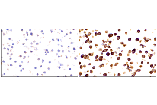Immunohistochemistry Image 12: Cox2 (D5H5) XP<sup>®</sup> Rabbit mAb (BSA and Azide Free)