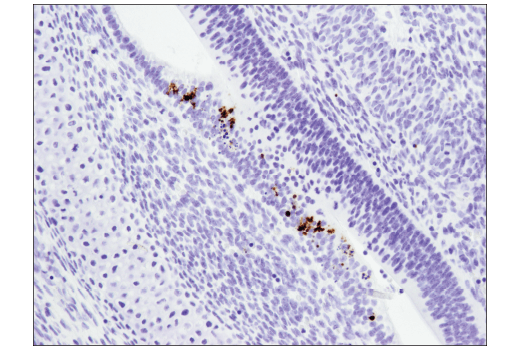 Immunohistochemistry Image 2: Cleaved PARP (Asp214) (D6X6X) Rabbit Monoclonal Antibody (BSA and Azide Free)