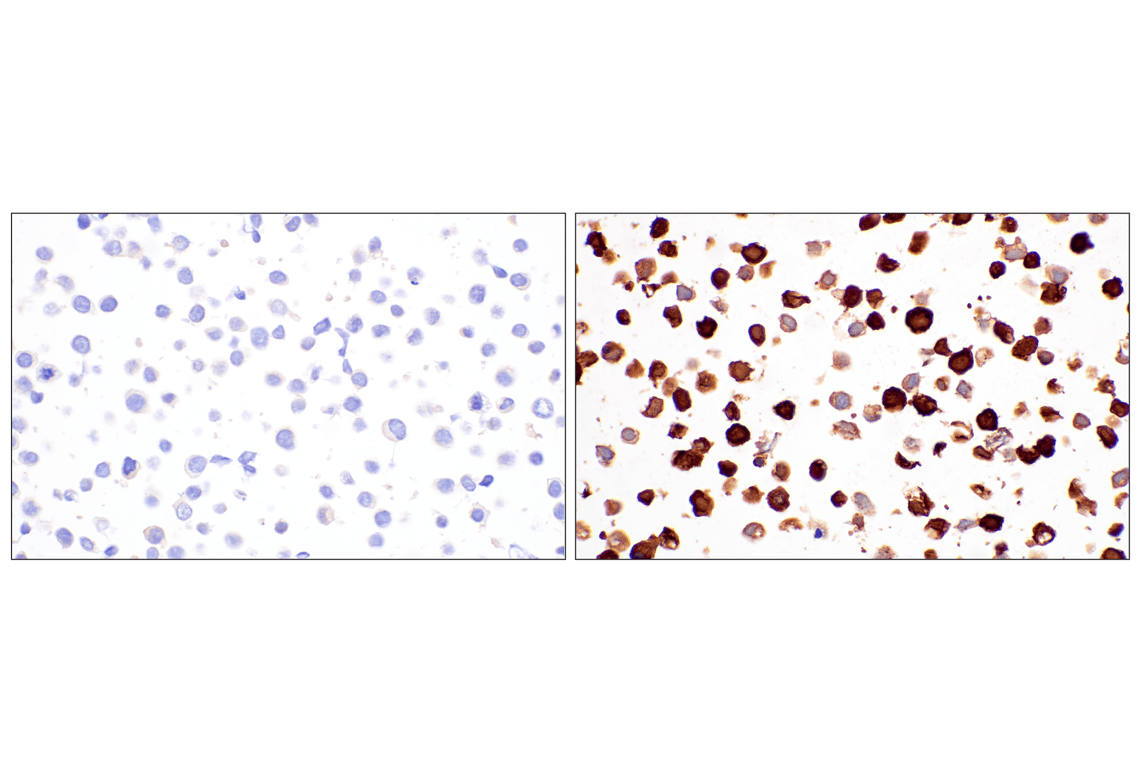 Immunohistochemistry Image 3: Kir4.1 (F5Z2T) Rabbit Monoclonal Antibody