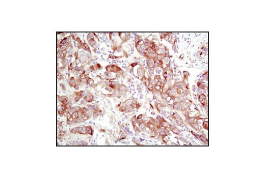 Immunohistochemistry Image 1: TGM2 (D11A6) Rabbit Monoclonal Antibody