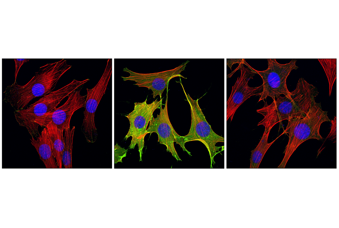 Immunofluorescence Image 1: Phospho-Tyrosine (P-Tyr-1000) MultiMab<sup>®</sup> Rabbit Monoclonal Antibody mix