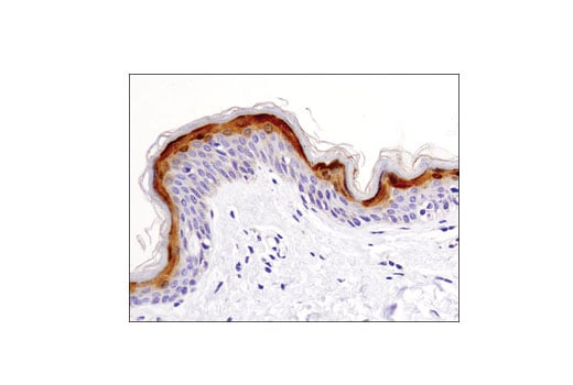 Immunohistochemistry Image 3: FABP5 (D1A7T) Rabbit Monoclonal Antibody (BSA and Azide Free)