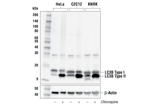 undefined Image 18: Xenophagy Antibody Sampler Kit