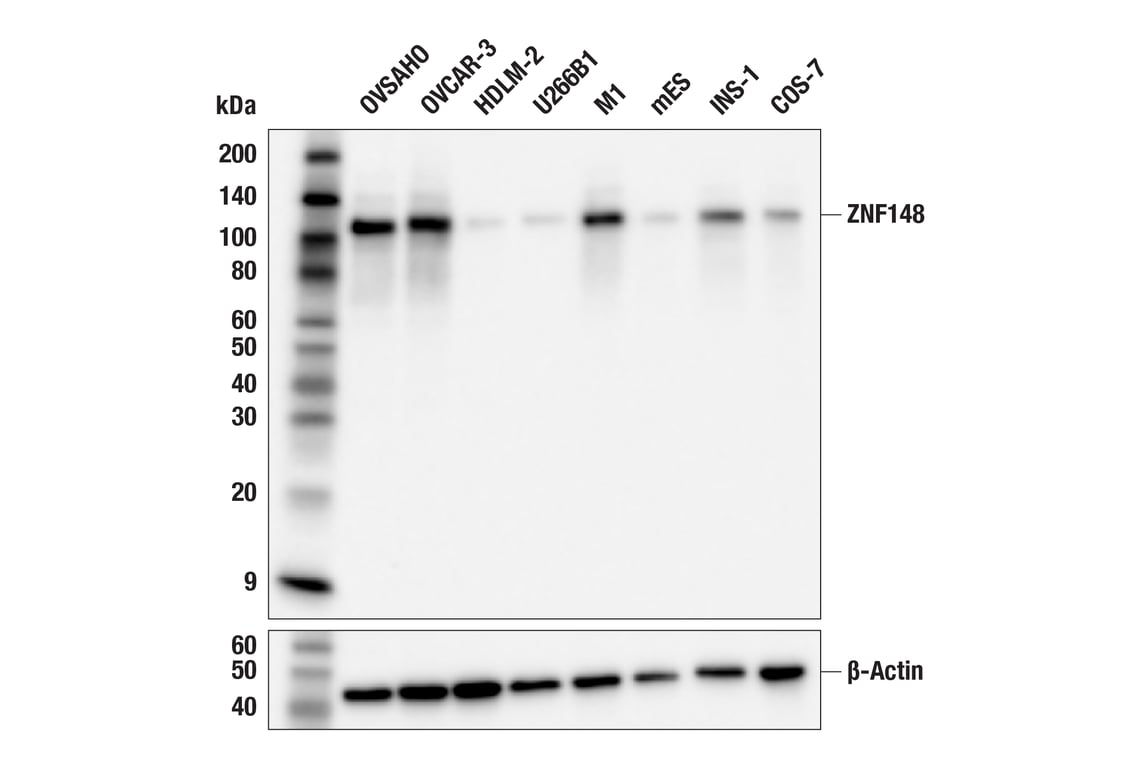 Western Blotting Image 2: ZNF148 (F5N3O) Rabbit Monoclonal Antibody