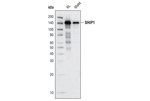 Western Blotting Image 1: SHIP1 (C40G9) Rabbit mAb