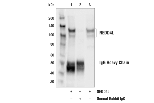 Immunoprecipitation Image 1: NEDD4L Antibody