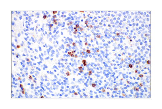 Immunohistochemistry Image 5: CD57 (HNK-1) Mouse Monoclonal Antibody