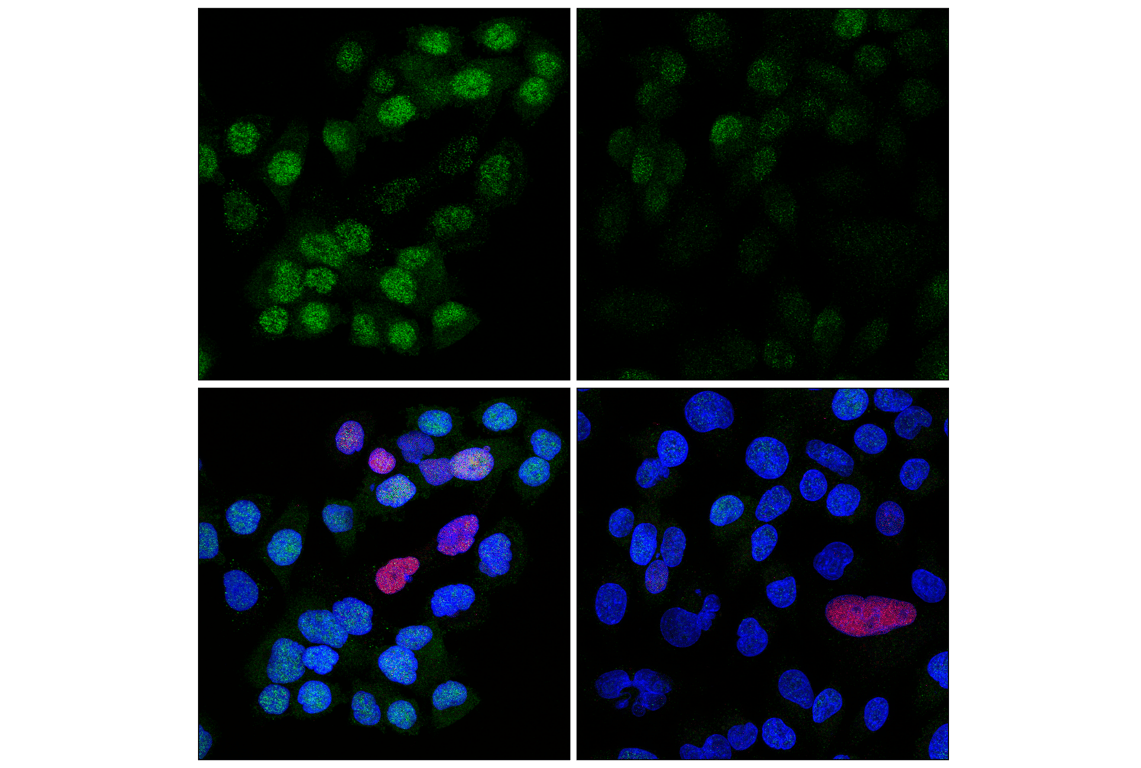 Immunofluorescence Image 1: Chk1 (2G1D5) Mouse mAb