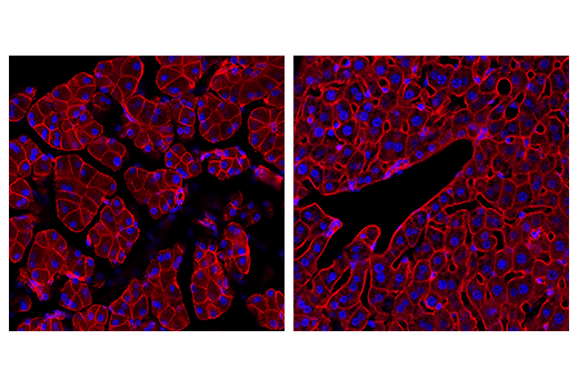Immunofluorescence Image 2: Ras (E4K9L) Rabbit Monoclonal Antibody (Alexa Fluor<sup>®</sup> 555 Conjugate)