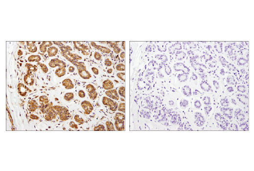 Immunohistochemistry Image 4: Lyric/Metadherin (D5Y8R) Rabbit Monoclonal Antibody