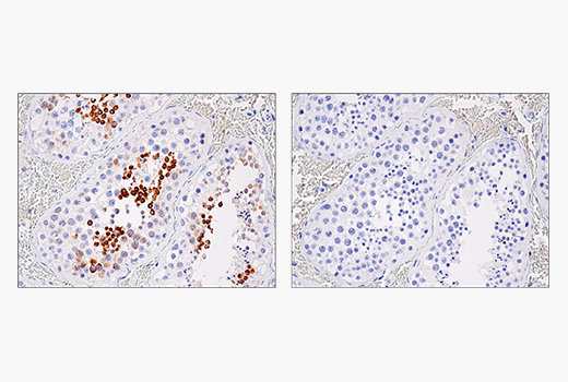 Immunohistochemistry Image 7: IL-13RA2/CD213a2 (E7U7B) Rabbit Monoclonal Antibody