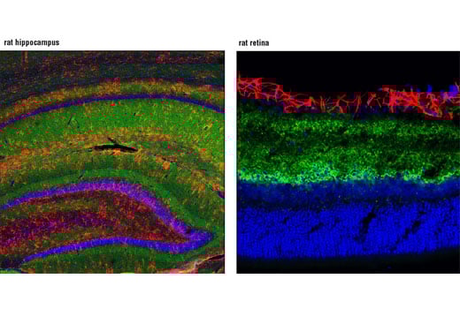Immunofluorescence Image 1: GAP43 (D9C8) Rabbit Monoclonal Antibody (BSA and Azide Free)