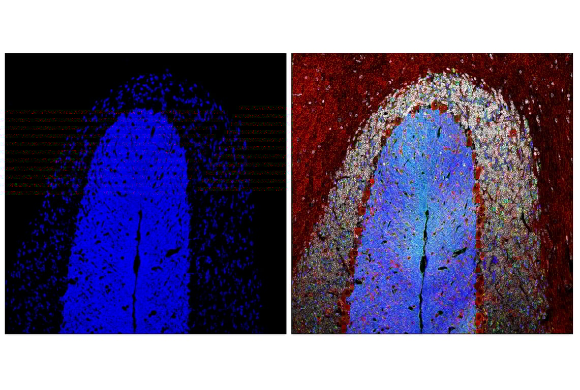 Immunofluorescence Image 2: Bassoon (D63B6) Rabbit Monoclonal Antibody (Alexa Fluor<sup>®</sup> 647 Conjugate)