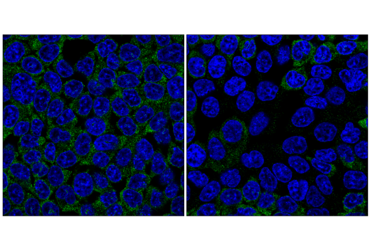 Immunofluorescence Image 1: YTHDF1 (E9P6V) Rabbit Monoclonal Antibody
