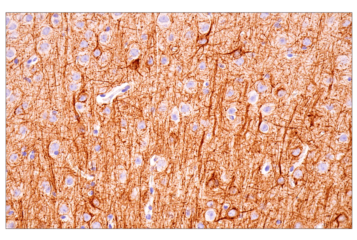 Immunohistochemistry Image 5: Neurofilament-M (E7L2T) Rabbit Monoclonal Antibody (BSA and Azide Free)