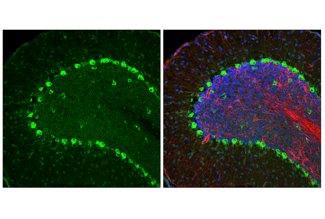 Immunofluorescence Image 2: YTHDF3 (E2J9I) Rabbit Monoclonal Antibody