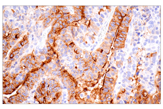 Immunohistochemistry Image 1: CA 19-9 (C241:5:1:4) Mouse Monoclonal Antibody