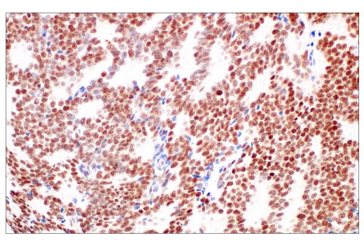 undefined Image 37: ATM Substrates Antibody Sampler Kit
