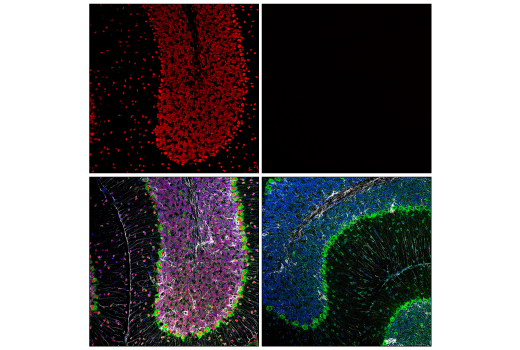Immunofluorescence Image 1: MeCP2 (D4F3) Rabbit Monoclonal Antibody (BSA and Azide Free)