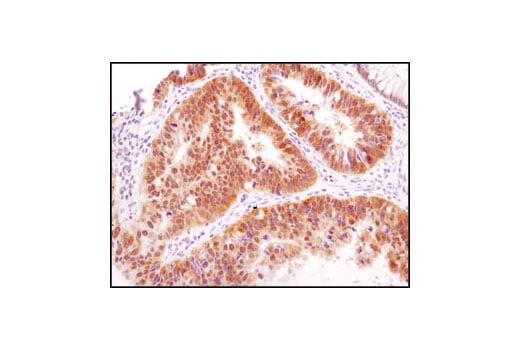undefined Image 15: HSP/Chaperone Antibody Sampler Kit