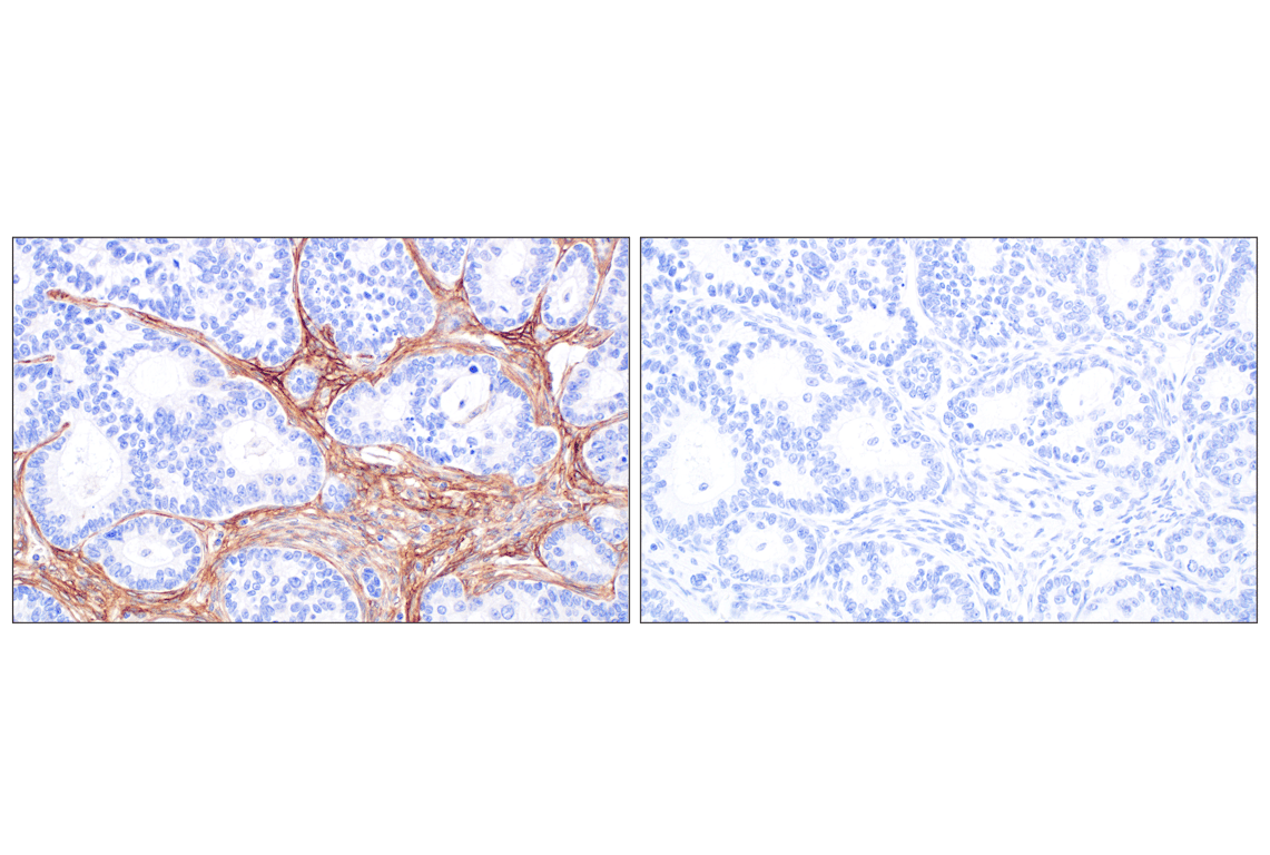 Immunohistochemistry Image 8: CD105/Endoglin (F9C5Q) Rabbit Monoclonal Antibody (BSA and Azide Free)
