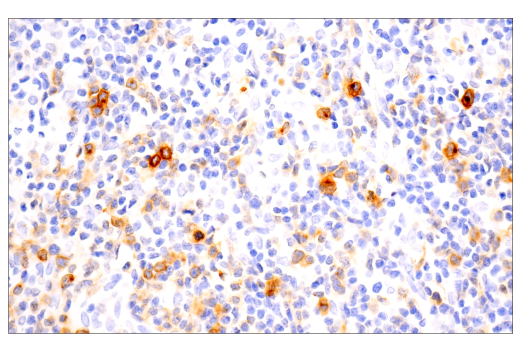Immunohistochemistry Image 1: TNFRSF8/CD30 (E7E4D) Rabbit Monoclonal Antibody