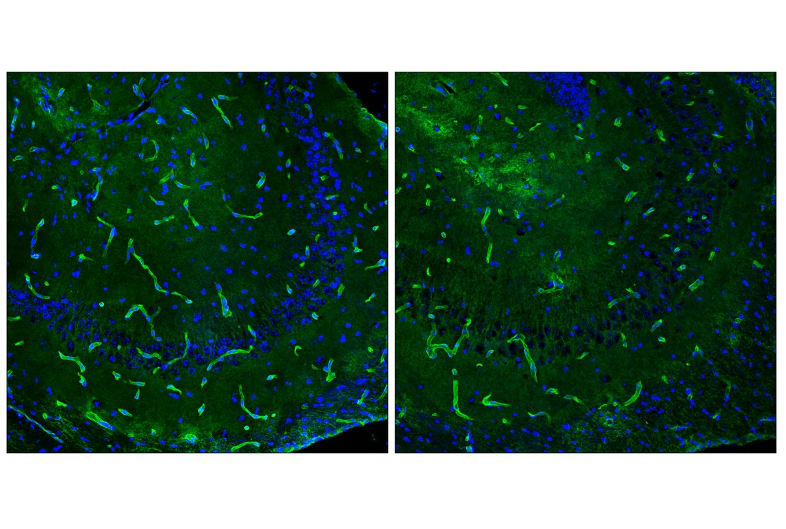 Immunofluorescence Image 4: AQP4 (D1F8E) Rabbit Monoclonal Antibody