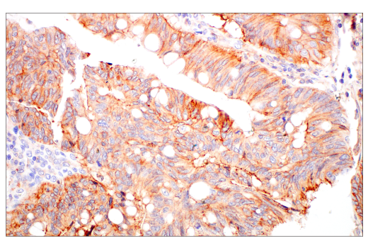 Immunohistochemistry Image 5: JAM-A (E8D2N) Rabbit Monoclonal Antibody