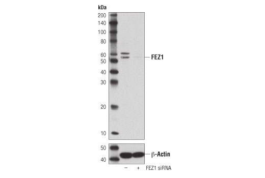 Western Blotting Image 3: FEZ1 (D9R8Q) Rabbit Monoclonal Antibody