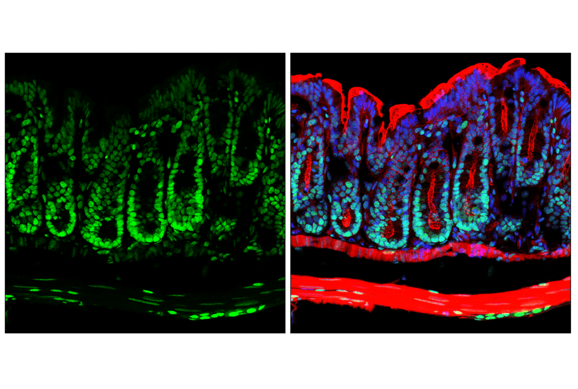 Immunofluorescence Image 2: HP1 alpha (F3K7M) Rabbit Monoclonal Antibody
