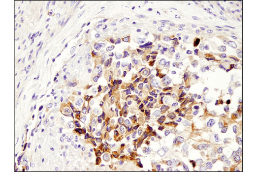 Immunohistochemistry Image 4: HGF beta (D6S7D) Rabbit Monoclonal Antibody