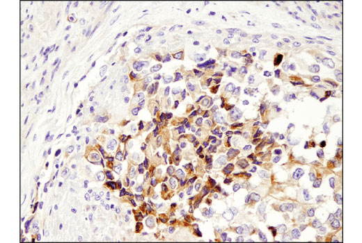 undefined Image 23: Cancer-associated Growth Factor Antibody Sampler Kit