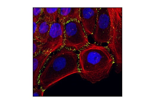 Immunofluorescence Image 1: P-Cadherin (C13F9) Rabbit Monoclonal Antibody