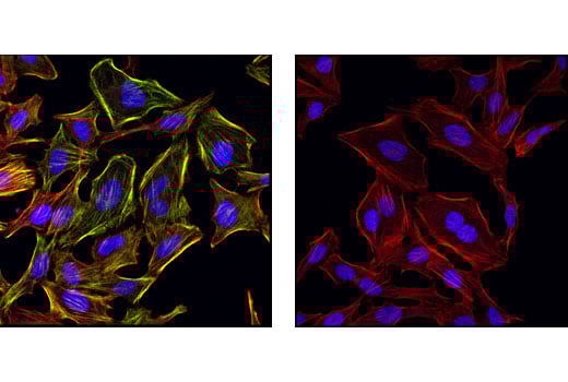 Immunofluorescence Image 1: Phospho-Myosin Light Chain 2 (Ser19) Antibody
