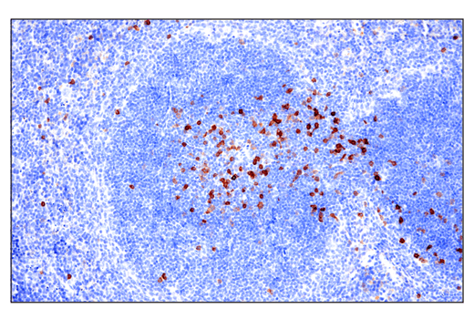 Immunohistochemistry Image 1: IL-2R alpha/CD25 (E4B2Z) Rabbit Monoclonal Antibody